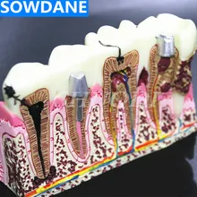 Стоматологические зубы общая Патология модель обучения Модель зуб стоматолога для медицинских исследований обучение Стоматологическая коммуникационная модель