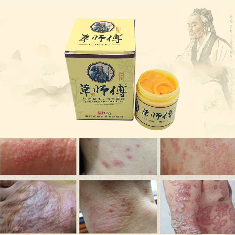 29A Профессиональный мазь для лечения псориаза лекарственный ингредиент безопасность для все виды кожи проблемы 29A крем псориаза