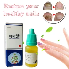 5 шт Лечение ногтей onychomicosis Paronychia против грибковой инфекции ногтей хороший результат Китайский Травяной Уход за ногтями