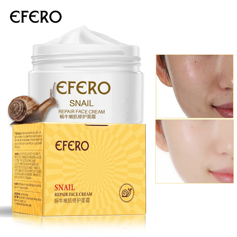 

EFERO Snail Face Cream Acne Scar Removal Cream For Face Skin Care Whitening Cream Snail Marks Nourishing Anti Aging TSLM2