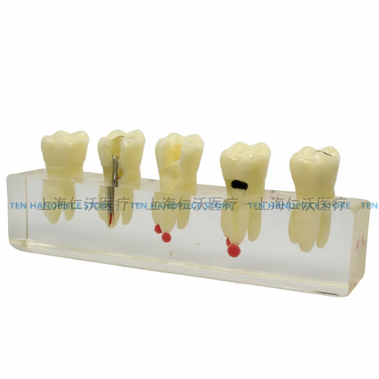 2018 good quality Dental root canal model Dental practice teaching model Dental prosthetic dental teaching training 2018 good quality Dental root canal model Dental practice teaching model Dental prosthetic dental teaching training