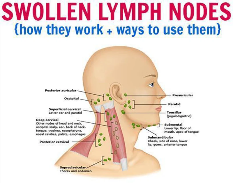 essential-oils-for-swollen-lymph-nodes_720x_38938110-dfac-4a7b-8780-a6f27b241ff6_300x