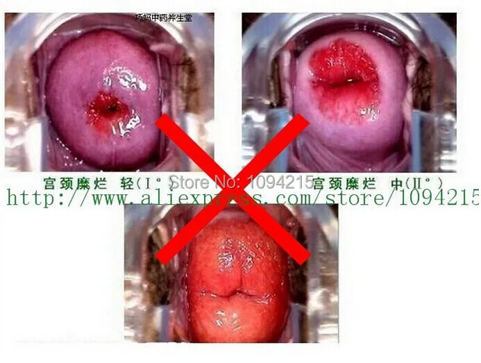 Regret, that Having sex with a tampon think Have advised Having sex with a tampon speaking