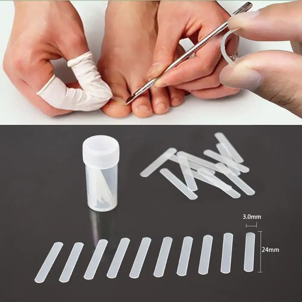 Incarnated nails kit complete clip & spray 3Pcs Ingrown Toenail Pedicure Correction Tools Straightening Clip Nail