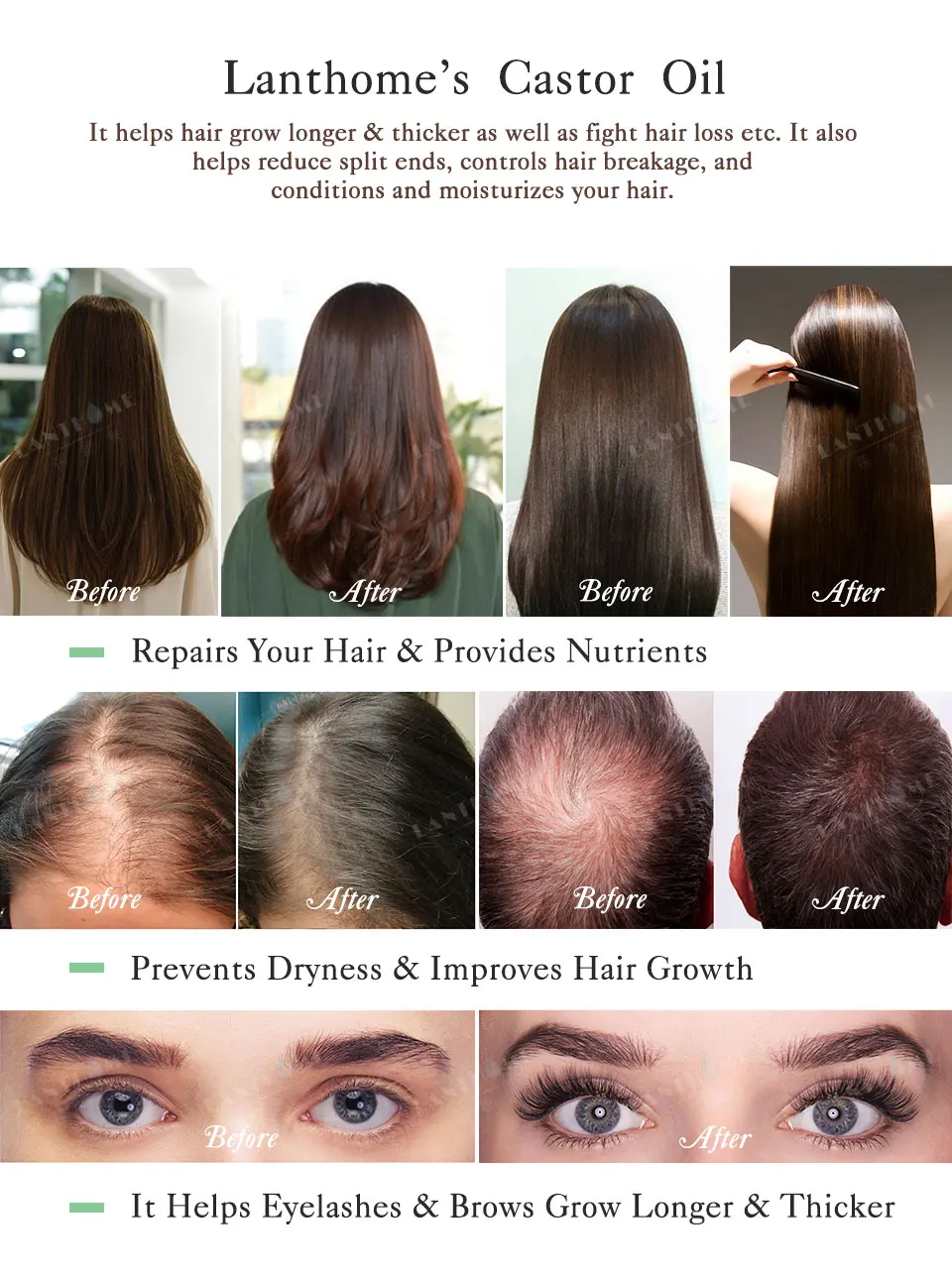 Jaysuing Hair Essence Hair Care Essential Castor Oil Conditioner Soft  Prevent Hair Loss Nourish Repir Hair Growth Hair Care(60ml), jaynehoe