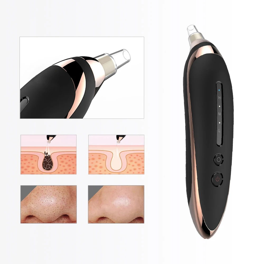 

Electric Blackhead Vacuum Cleaner Suction Instrument Acne Facial Beauty
