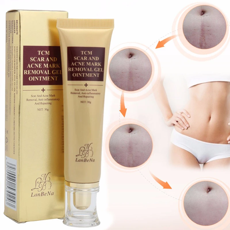2018-New-arrival-LANBENA-TCM-SCAR-AND-ACNE-MARK-REMOVAL-GEL-drop-shipping-Profession-Acne