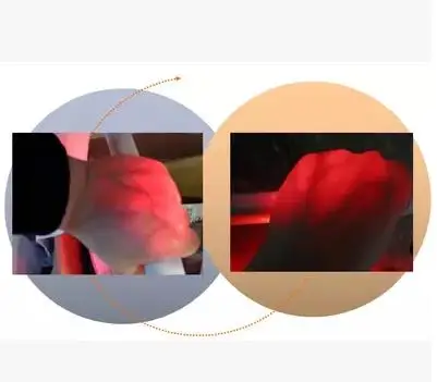 Preise Her generation erweiterte Sowohl Erwachsene Und Kinder Geeignet Vene Viewer Display Lichter Imaging Finden Vene Medizinische Vene Finder