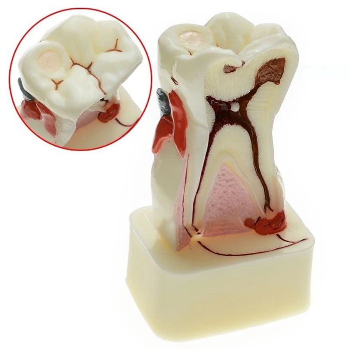 

Orthodontic Braces,Dental Teeth Comprehensive Disease Study Teaching Tooth Model 380331
