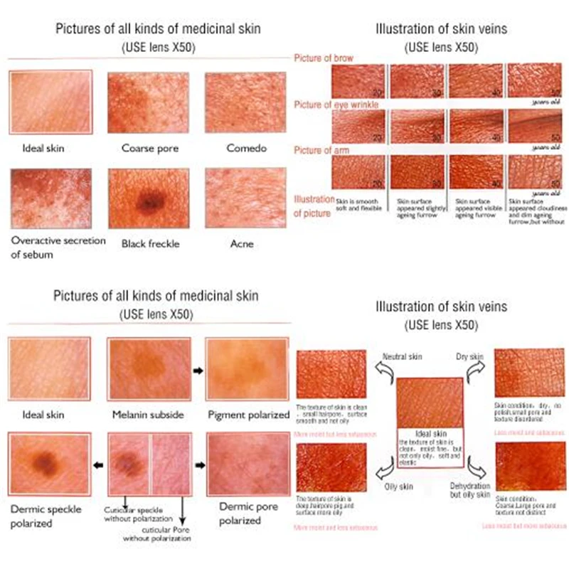 Уход за кожей 5,0 МП HD USB 3D кожи объем диагностический анализатор увлажнение кожи на лице масло акне метр тестер анализа Красота инструменты