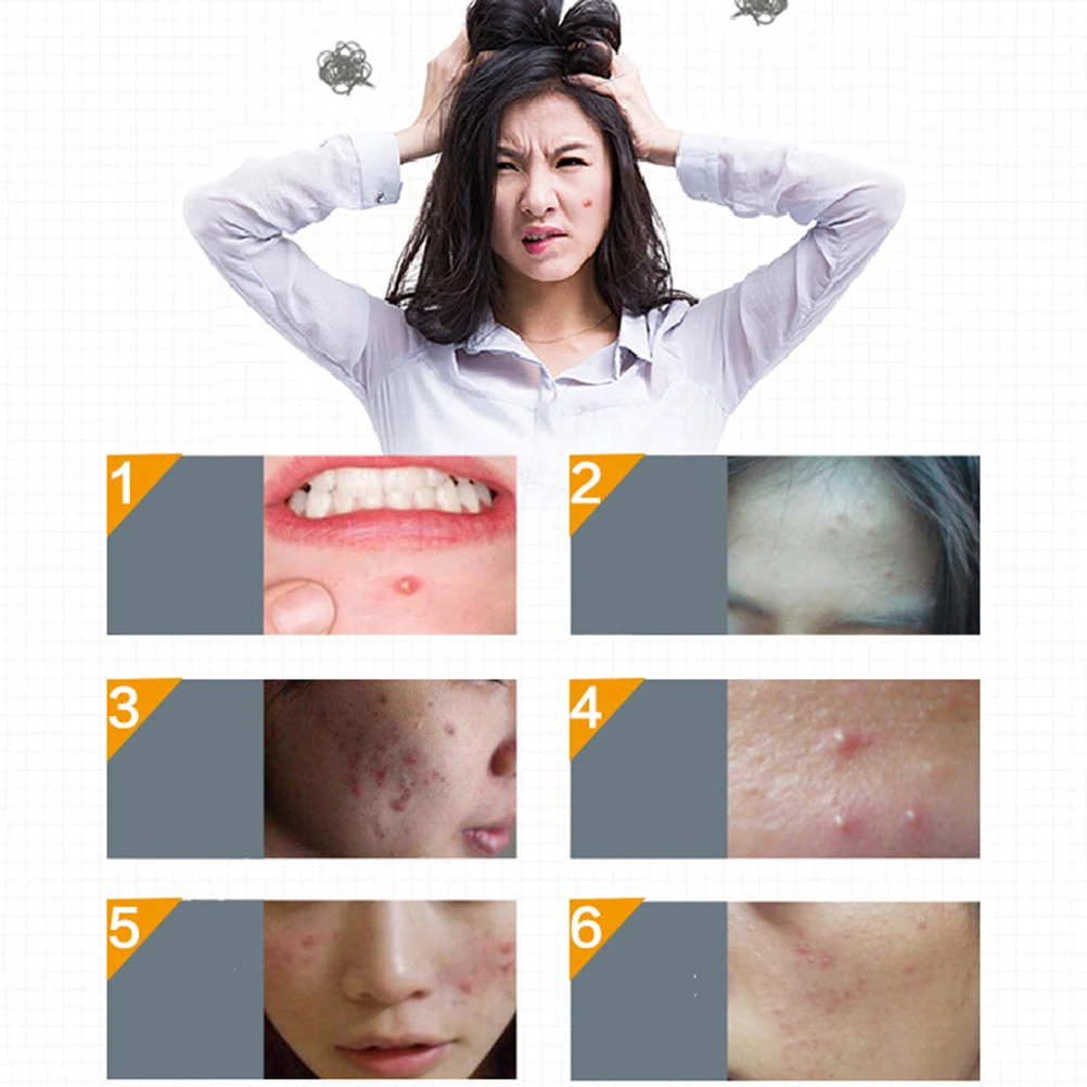Online 30 pcs box Stiker Patch Stiker Kecil Makeup Terlihat Jerawat Pengobatan Jerawat anti inflamasi Smoothing Stiker Jual 30 pcs box Stiker Patch Stiker Kecil Makeup Terlihat Jerawat Pengobatan Jerawat anti inflamasi Smoothing Stiker