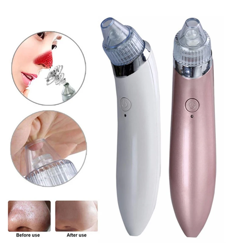 Электрический инструмент для удаления акне точка Noir Blackhead вакуумный экстрактор