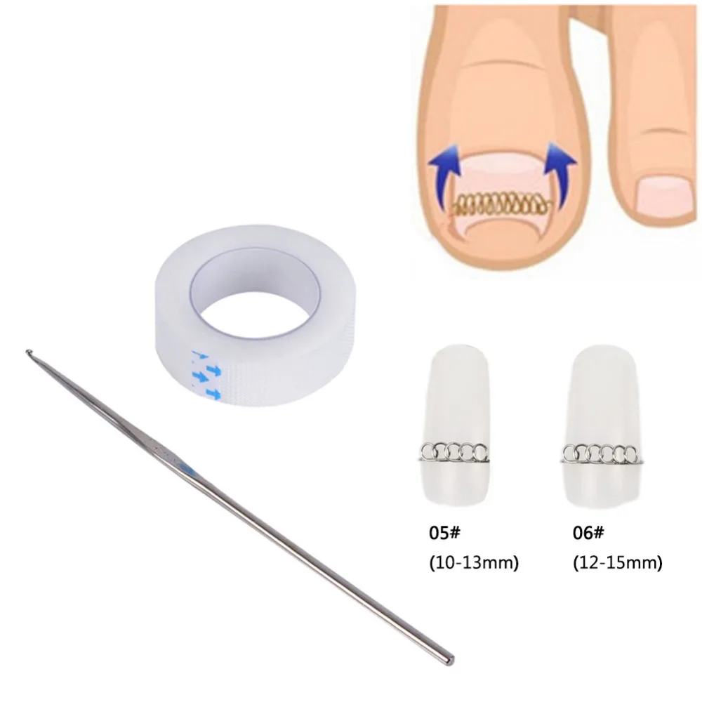 3Pcs/Lot Ingrown Toe Nail Correction Wire Fixer Pedicure Recover Paronychia Acronyx Bunion Corrector Foot Care Tools #255595