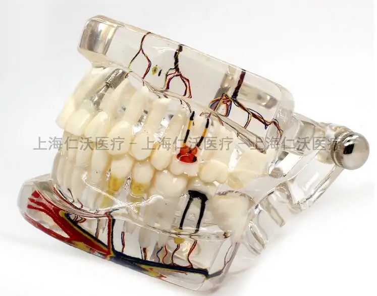 

standard Dental oral model Denture with nerve teeth model education teaching tooth model