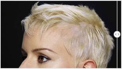 before-44