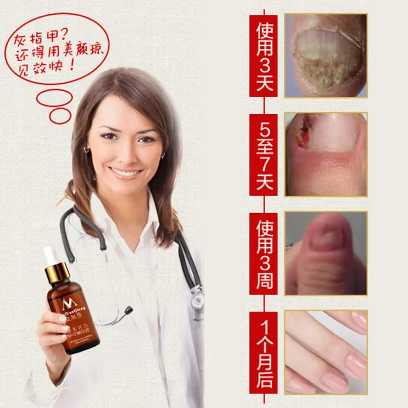 Hand Care Nail Treatment Essence Nail Foot Whitening Toe Nail Fungus Removal Serum