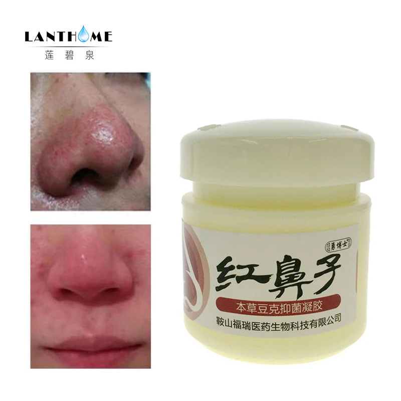 Chinese Herbal Medicine Rosacea Treatment Red Nose Acne Rosacea