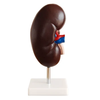 

2 Times Enlarged Human Kidney With Adrenal Glands Anatomical Medical Model Medical Science Educational Supplies