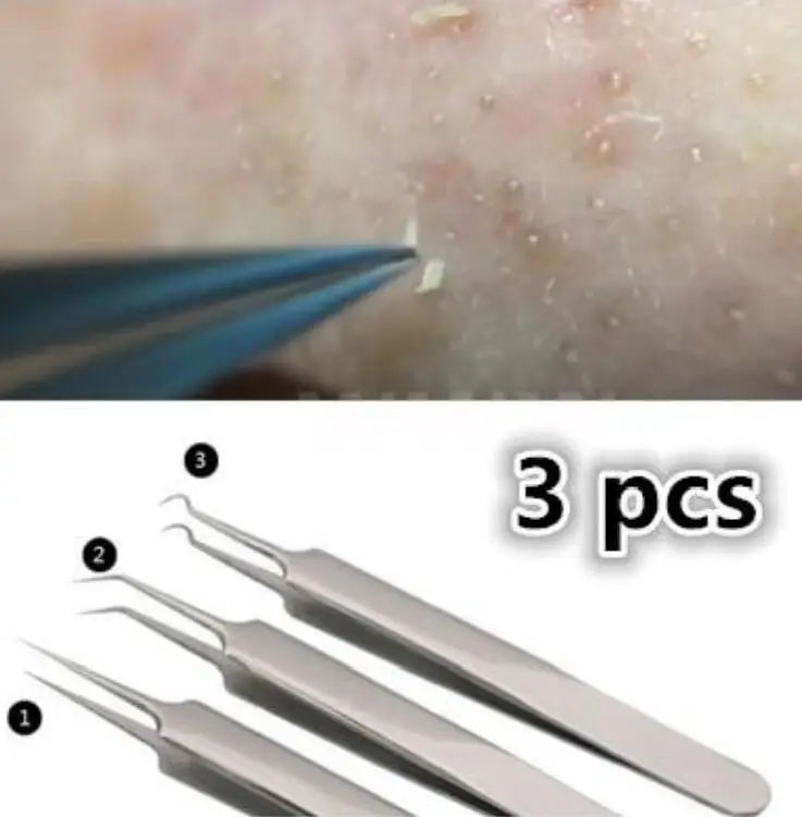 3 шт./партия, практичный игольчатый Пинцет для прыщей, удаления черных точек, прыщей, заостренный изгиб, уход за лицом, инструменты, экстрактор угрей и комедонов