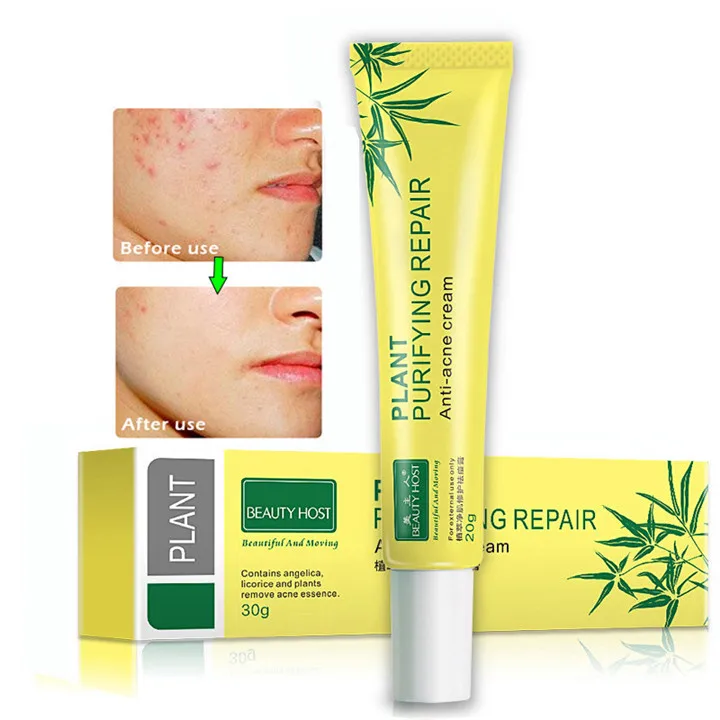 Anti Acne Cream / Oil Control / Shrink Pores/ Acne Scar Remove/ Face