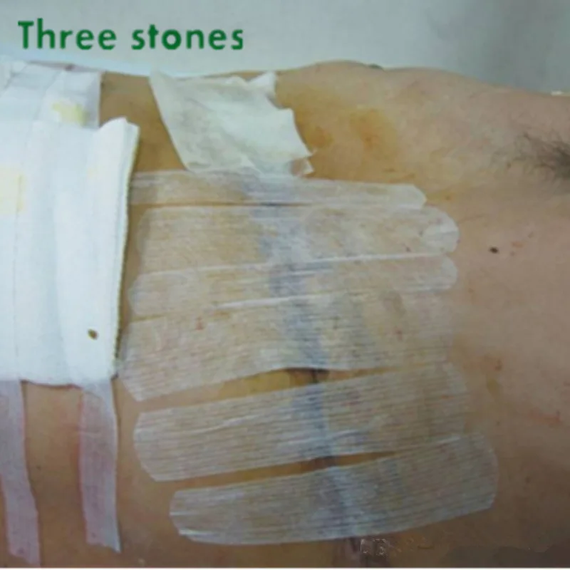 

6*38mm 6strips/ Bag Emergency First Aid Sterile Skin Closure Strip Tape Dressing For Surgical Wound And Cosmetic Surgery