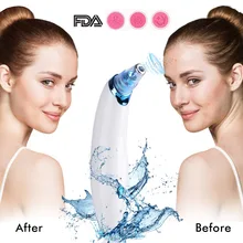 

Blackhead Remover Skin Tag Removal Skin Care Pore Vacuum Acne Pimple Removal Suction Tool Machine Face Clean Cleaner point noir