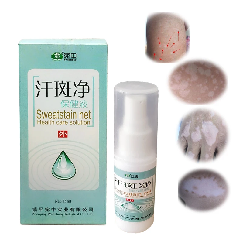 الطب الصيني العشبية رذاذ المهنية لعلاج الجلد الأبيض بقعة البهاق الأكزيما sweatstain صافي حل الرعاية الصحية