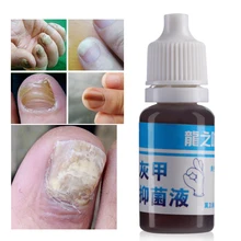 1 бутылка 5 мл Модный яркий ремонт ногтей Onychomycosis эссенция для удаления лечение ногтей от грибка жидкость анти-инфекция Уход за ногами
