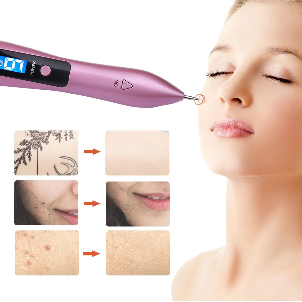 Laser-plasma beauty pen with the power button and small screen used to remove moles, dark spots, and the tattoo on the face 