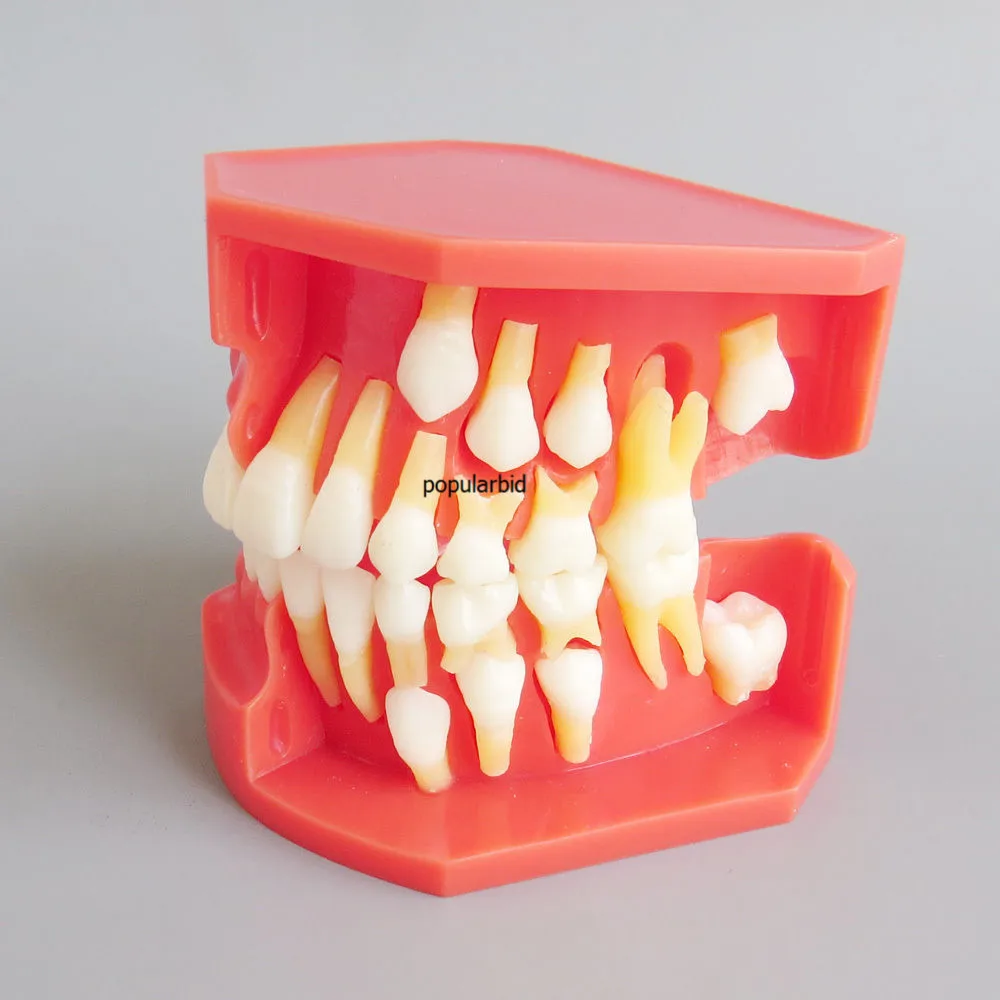 

Primary Teeth Alternative Model for 3-6-years-old Child showing the eruption of primary and permanent teeth development