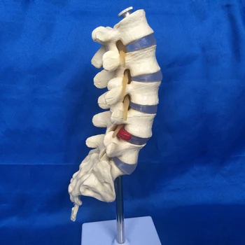 

Lumbar Model Spine Small Five Lumbar Spine Model with Coccyx Model Lumbar Bone Lesions Model Teaching Supplies