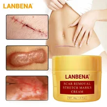 LANBENA face care ointment natural plant epidermal growth factor acne scar removal cream repair elasticity lift skin care 40g