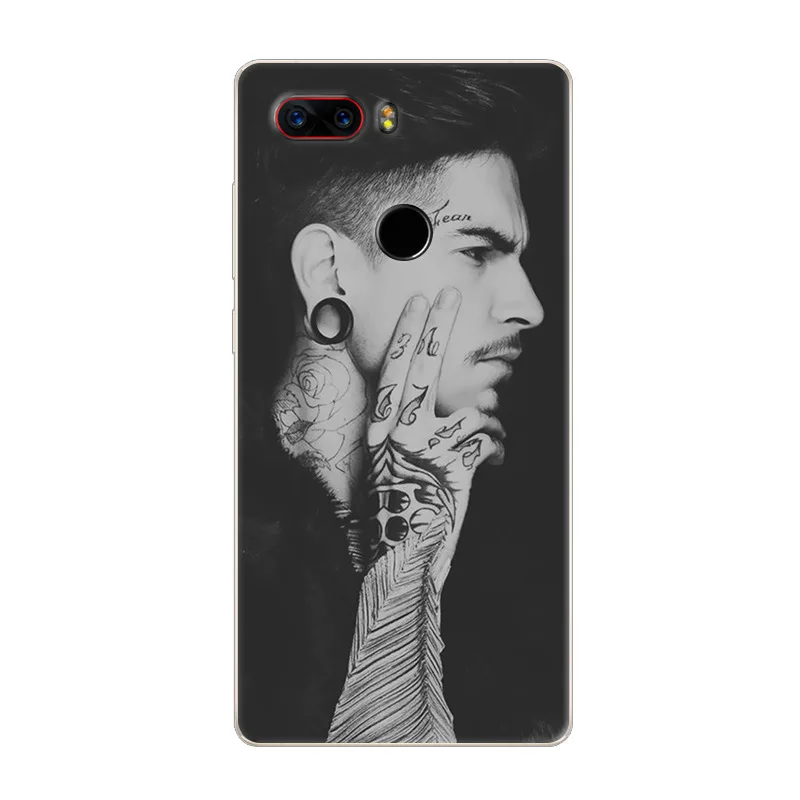 For ZTE Nubia Z17S Case 5.73 Cartoon Cat Animal Hard PC Back Cover Full Body Protective Shell For Nubia Z17S Silicone TPU Case (23)