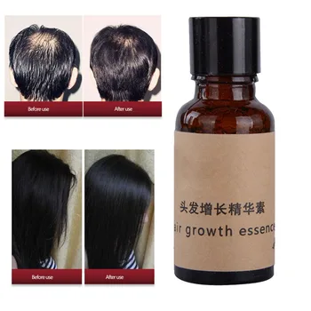 

New Herbal Keratin Fast Hair Growth alopecia hair loss liquid Ginger Hair Growth Pilatory Oil