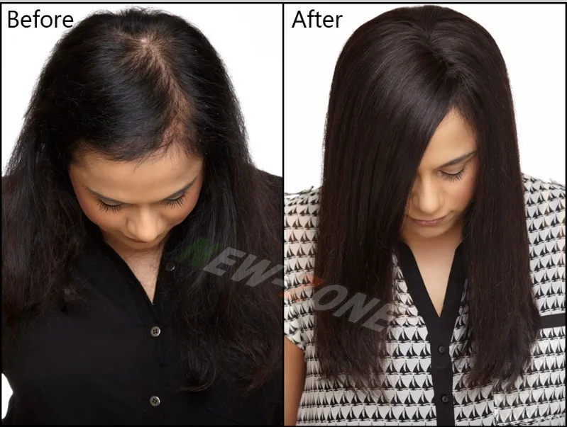 Быстрое решение для роста волос жидкость для всех типов выпадения волос 20 мл для лечения волос 100% натуральный травяной здоровый