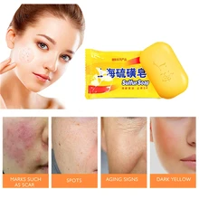 Чистое Натуральное сульфатное мыло Шанхай эффектное лечение зуда от акне, псориаза клеевой дерматит мыло для ухода за кожей 85 г