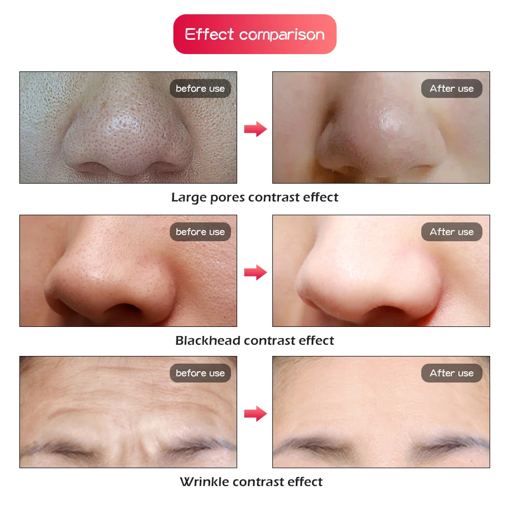  7 Colors Led Face Mask Skin Rejuvenation Wrinkle Acne Removal LED Facial Photon Mask Beauty Therapy - 33055598342