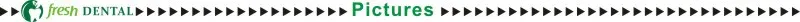 Mangueira de Tubo de Silicone de Alta Tubo sem Conector Tubo de Silicone Buracos Handpiece Velocidade Dental Dois Sl1116 1 pc 2 2 Tubo de Silicone de Alta Velocidade Dental