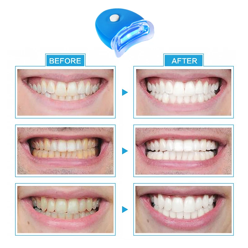 1 шт., стоматологический отбеливающий светильник для зубов, Мини светодиодный ускоритель отбеливания зубов для отбеливания зубов, косметический лазер, товары для красоты полости рта