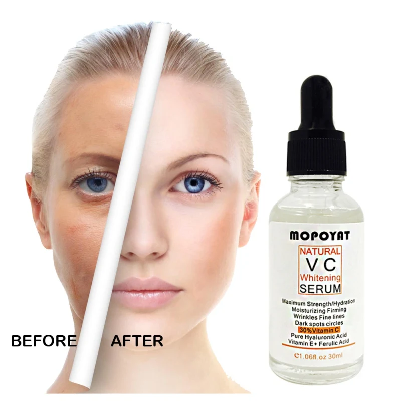 

Beauty Natural Vitamin C Serum Moisturizing Whitening Anti-Aging Anti-Wrinkle Facial eye Skin Care Serum A