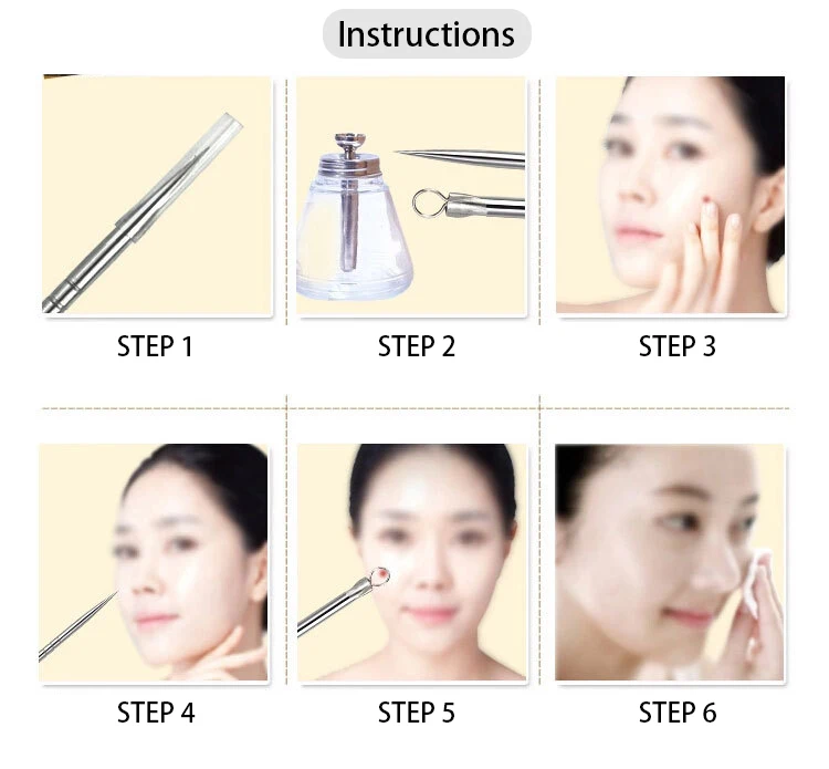 3647578664_1383723607