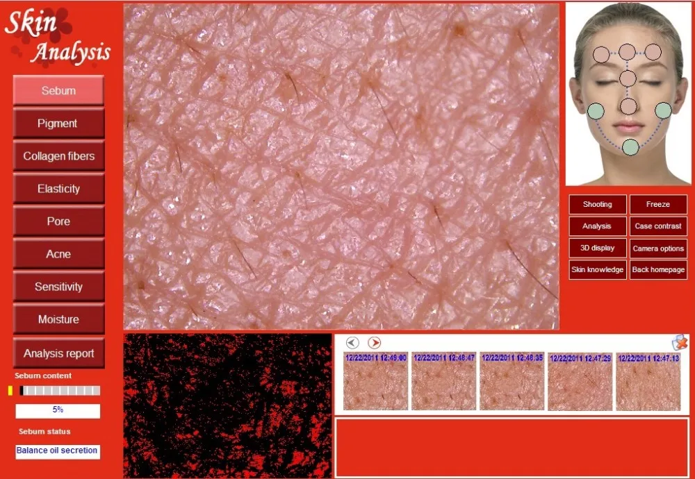 skin analyzer