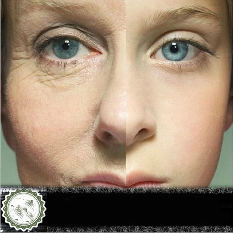 2016 Hot Face Cream Wrinkle Remove Circles Anti-aging Concentrate 10ml Free Shipping Instantly Ageless Cosmetics Makeup