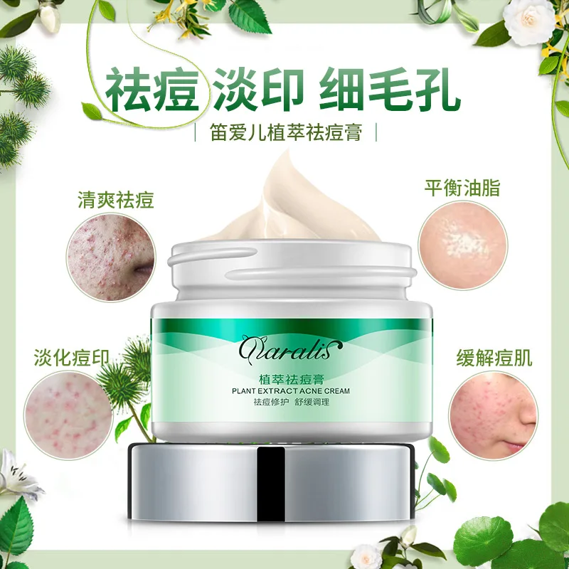 new Ingredients of Chinese Medicine Anti acne cream Whitening Ageless