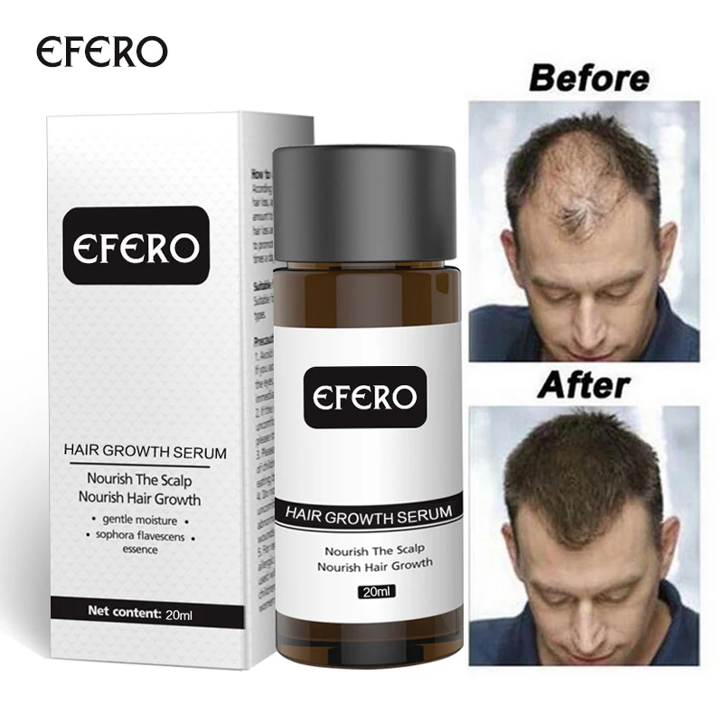 EFERO эссенция для роста волос, сыворотка для быстрого роста волос, эссенция для предотвращения облысения, сыворотка против выпадения волос, продукты для ухода за волосами, густые