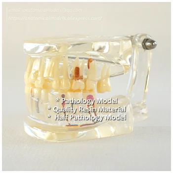 

DH/13066, Half Pathology Model, Pathology Dental Model, Medical Science Educational Teaching Anatomical Models