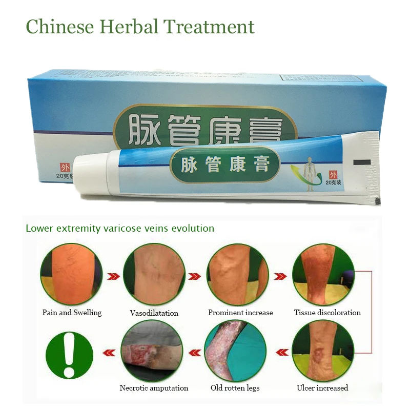 1 коробки Китайский натуральная косметика фитотерапии для лечения варикозного сосудистого воспаления массажный крем лечение варикозной