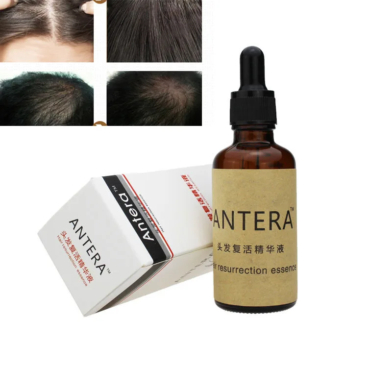 Новое средство для роста волос выпадение волос Жидкое натуральное чистое растительное эфирное масло быстрые средства для роста волос