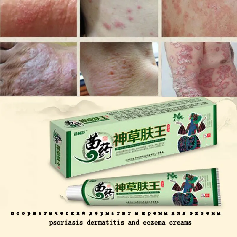 100% Natural Herbal Creams Body Psoriasis Cream Perfect For Dermatitis ...