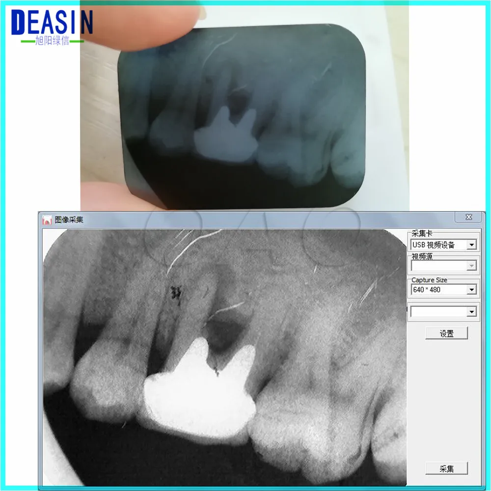 Зубные Многофункциональный X-ray фильм читателя стоматологический рентгеновский Плёнки Reader